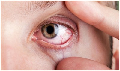 आंखों का कराना है ईलाज, तो जरूर पढ़ लें स्वास्थ्य मंत्रालय के ये दिशानिर्देश